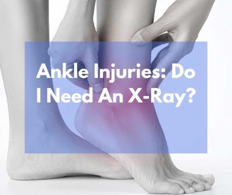 Ottowa-Ankle-Rules